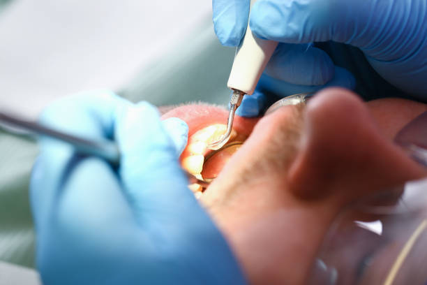 Best Broken or Cracked Tooth Emergency Dentist in Elmsford, NY