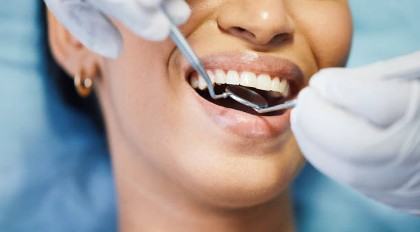 Best Emergency Dentist for Lost Fillings or Crowns in Elmsford, NY